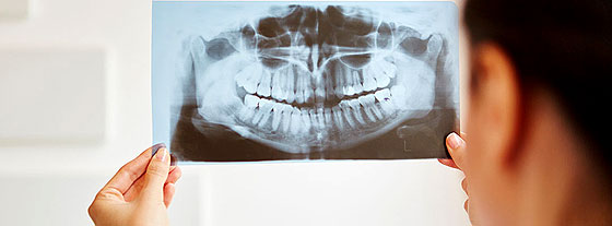 Orthopanaufnahme Kroatien